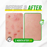 Have A Good Cream Snail & Centella - Korean-Skincare